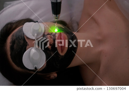 Close-up of a woman undergoing carbon laser facial treatment with protective goggles and a green laser light applied to the skin, a modern skincare procedure for deep cleansing and rejuvenation. Close-up of a woman undergoing carbon laser facial treatment with protective goggles and a green laser light applied to the skin, a modern skincare procedure for deep cleansing and rejuvenation. 130697004