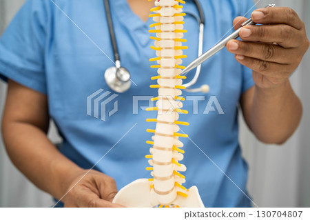 Asian doctor holding spinal nerve and bone model, Lumbar spine displaced herniated disc fragment for treatment medical in the orthopedic department. 130704807