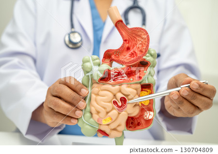 Digestive system with stomach and intestine, Asian doctor holding human anatomy model for study diagnosis and treatment in hospital. Digestive system with stomach and intestine, Asian doctor holding human anatomy model for study diagnosis and treatment in hospital. 130704809