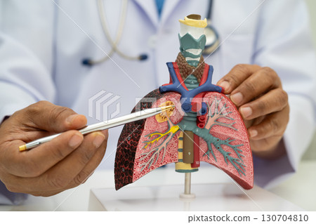 Pneumonia, lung cancer, Asian doctor holding human anatomy model for study diagnosis and treatment in hospital. 130704810