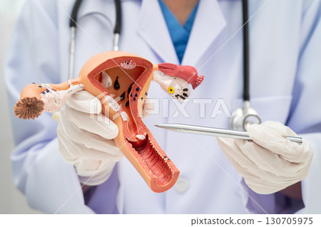 Uterus, doctor holding human anatomy model for study diagnosis and treatment in hospital. 130705975