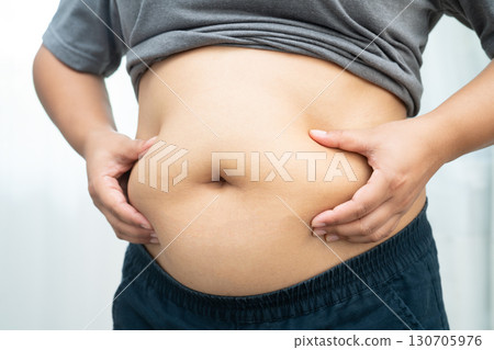 Asian woman use hand to squeeze fat belly big size overweight and obesity. 130705976