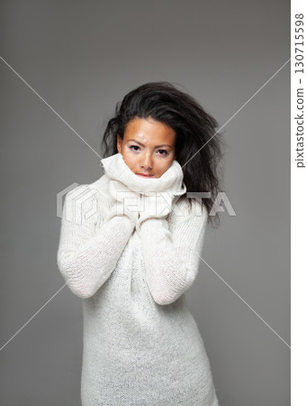 Young woman with vitiligo in white turtleneck Young woman with vitiligo in white turtleneck 130715598