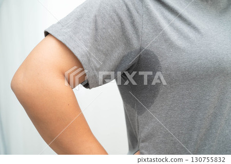 Asian woman have problem black armpit beauty skin care. 130755832