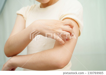 Asian woman itching of skin diseases using hand scratching. Asian woman itching of skin diseases using hand scratching. 130769985
