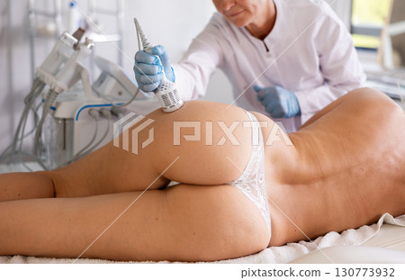 Aesthetician performing cryotherapy using cooling attachment on female buttocks 130773932