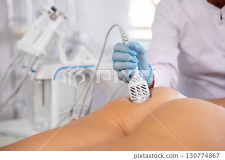 Aesthetician administering ice hammer therapy to tighten skin on female buttocks Aesthetician administering ice hammer therapy to tighten skin on female buttocks 130774867