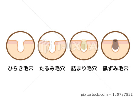 毛孔類型 130787831