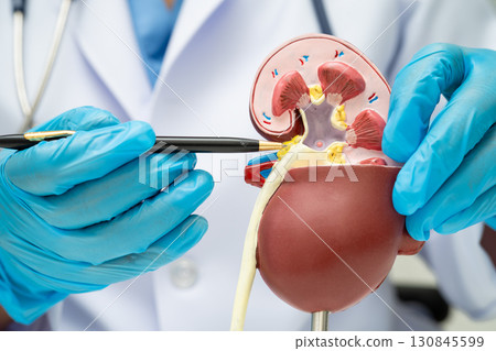Chronic kidney disease, doctor with model for treatment urinary system, urology, Estimated glomerular filtration rate eGFR. Chronic kidney disease, doctor with model for treatment urinary system, urology, Estimated glomerular filtration rate eGFR. 130845599