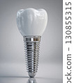 A highly detailed, realistic dental implant on a clean white background.  130855315
