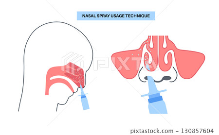Proper nasal spray usage 130857604