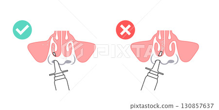 Proper nasal spray usage 130857637
