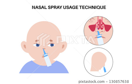 Proper nasal spray usage 130857638