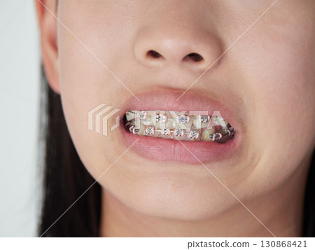 孩子們可以開心地展示牙齒矯正治療後的口腔狀況。 130868421