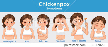 Chickenpox Symptoms Illustrated in Children with Facial Expressions 130869656