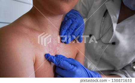 The child's skin shows signs of an allergic rash during the examination. 130871633