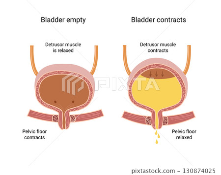 Human Bladder Anatomy. Empty and full urinary bladder. The bladder muscles contract while the sphincter relaxes. Medical illustration 130874025