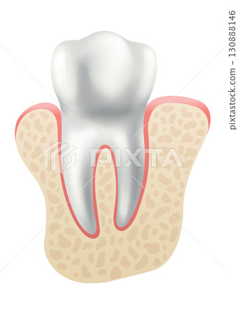 Dental implant. Medical educative infographic poster. Teeth implant, realistic vector design of dentistry. Healthcare, dentist and orthodontist treatment 130888146