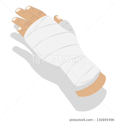 3D Isometric Flat Set of Hand Injury Treatment. Item 1 3D Isometric Flat Set of Hand Injury Treatment. Item 1 130895496