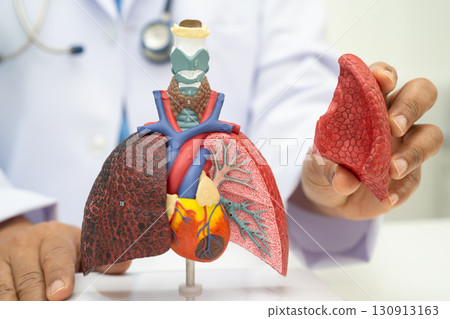 Pneumonia, lung cancer, Asian doctor holding human anatomy model for study diagnosis and treatment in hospital. 130913163