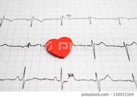 Electrocardiogram ECG heart wave, heart attack, cardiogram report. 130913164