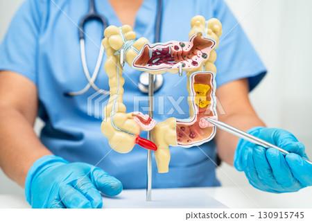 Intestine, Asian woman holding human anatomy model. 130915745