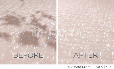 Skin melasma treatment before-and-after comparison. 3D-rendered illustration showing reduced pigmentation and dark spots fading. Visual results of laser therapy, microneedling, chemical peels, creams 130921397