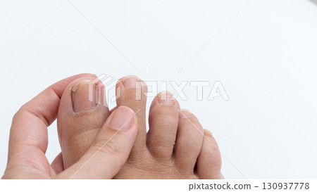 Close-up of a hand examining toes, showcasing foot health and hygiene, with a focus on nail care and skin texture in a clean environment Close-up of a hand examining toes, showcasing foot health and hygiene, with a focus on nail care and skin texture in a clean environment 130937778