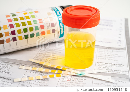 Urinalysis, urine cup with reagent strip pH paper test and comparison chart in laboratory. 130951248