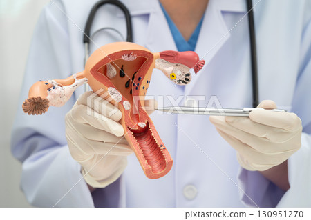 Uterus, doctor holding human anatomy model for study diagnosis and treatment in hospital. 130951270