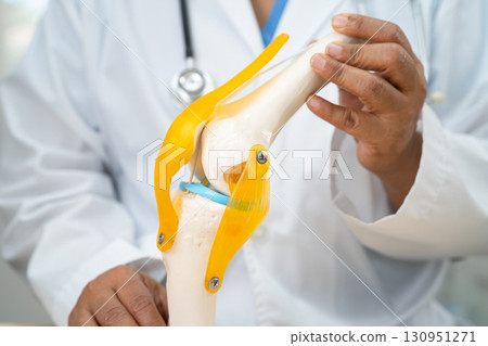Osteoarthritis of the knee, Doctor holding human knee joint orthopedic anatomy model in hospital. 130951271