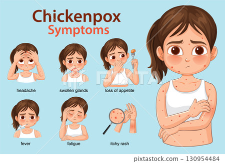 Chickenpox Symptoms Illustrated in Young Girl Vector Infographic 130954484