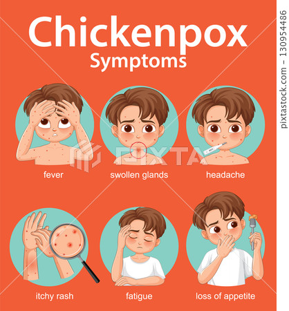 Chickenpox Symptoms Illustrated in Children with Facial Expressions Chickenpox Symptoms Illustrated in Children with Facial Expressions 130954486