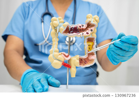 Intestine, Asian woman holding human anatomy model. 130967236