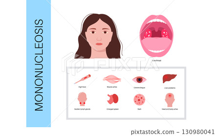 Mononucleosis symptoms poster 130980041