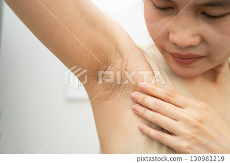 Asian woman have problem black armpit beauty skin care. 130981219