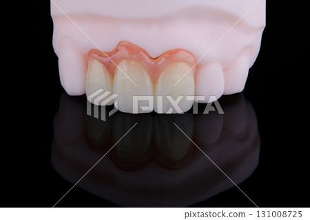High-quality three dental crowns made of zirconium for fixation to the frontal teeth of upper jaw. High-quality three dental crowns made of zirconium for fixation to the frontal teeth of upper jaw. 131008725