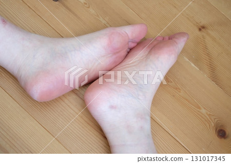 Legs of a woman in her 40s Legs of a woman in her 40s 131017345