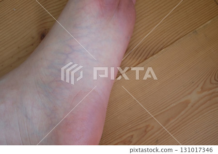 Legs of a woman in her 40s 131017346