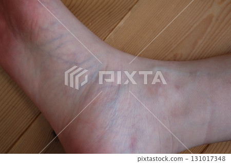 Legs of a woman in her 40s 131017348