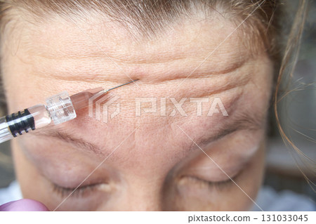 close up of mature caucasian female receiving botox injection on forehead close up of mature caucasian female receiving botox injection on forehead 131033045