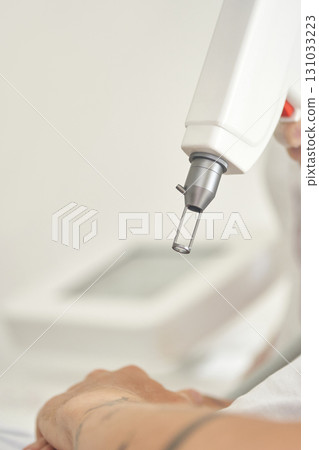 Close-up of laser hair removal on arm with device in medical clinic setting Close-up of laser hair removal on arm with device in medical clinic setting 131033223
