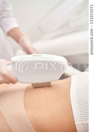 Caucasian female undergoing laser hair removal treatment on abdomen Caucasian female undergoing laser hair removal treatment on abdomen 131033251