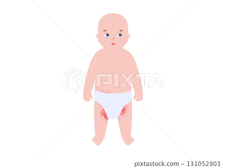 Diaper rash poster 131052803
