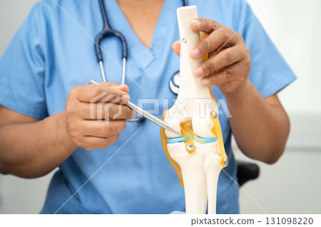 Osteoarthritis of the knee, Doctor holding human knee joint orthopedic anatomy model in hospital. Osteoarthritis of the knee, Doctor holding human knee joint orthopedic anatomy model in hospital. 131098220