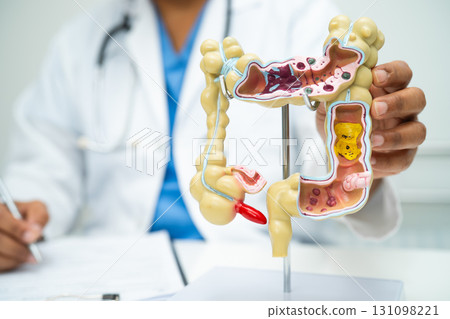 Intestine, appendix and digestive system, doctor holding anatomy model for study diagnosis and treatment in hospital. Intestine, appendix and digestive system, doctor holding anatomy model for study diagnosis and treatment in hospital. 131098221