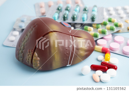 Liver model with pill drug treatment, Cirrhosis, Liver cancer, fatty liver. 131105562