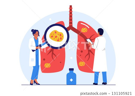 Illustration of Lung Cancer Diagnosis and Treatment 131105921