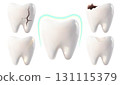 White teeth and teeth with various stages of decay and damage, a tooth with a filling and a tooth under protection on a white background 131115379