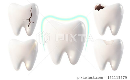 White teeth and teeth with various stages of decay and damage, a tooth with a filling and a tooth under protection on a white background White teeth and teeth with various stages of decay and damage, a tooth with a filling and a tooth under protection on a white background 131115379